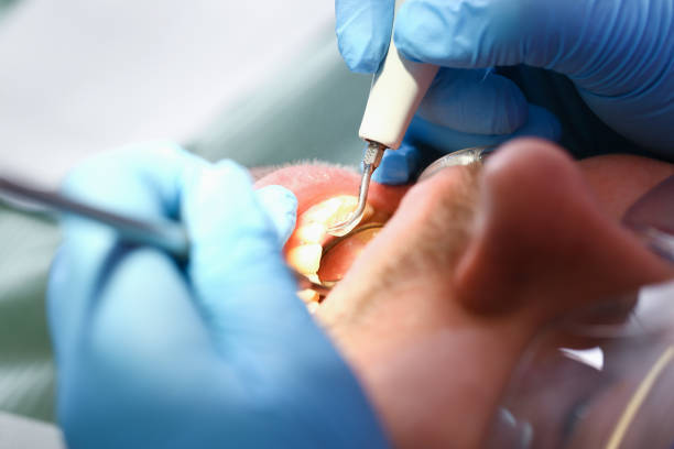 Best Walk-In Emergency Dentist in Edwardsburg, MI