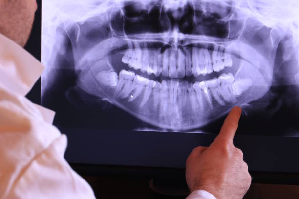 Best Emergency Tooth Extraction in Edwardsburg, MI