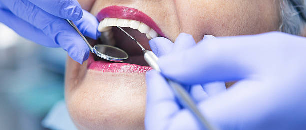 Best Walk-In Emergency Dentist in Edwardsburg, MI